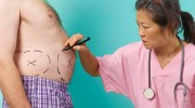 bariatric-weight-loss-surgery-thailand